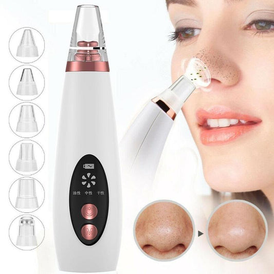Blackhead Pore Vacuum Cleaner Nose Cleanser Blackheads Remover Blackhead Acne Removal Button Face Suction Beauty Skin Care Tool - SD & CO.